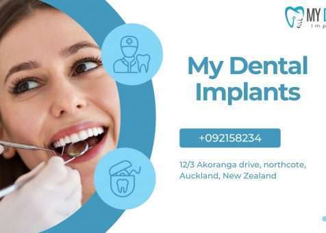 Dental Implant Experts Auckland