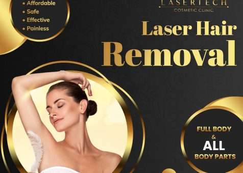 laser tattoo removal auckland